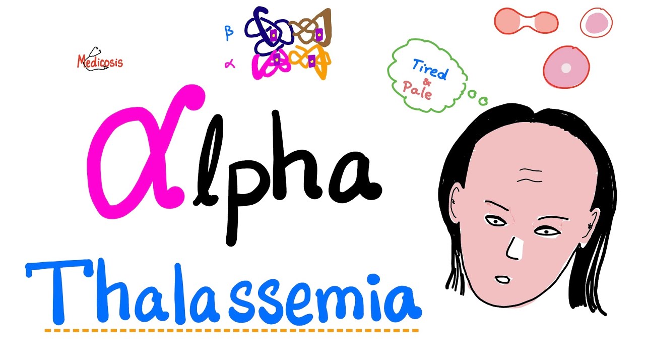 Alpha Thalassemia - All You Need to Know - Hematology Playlist