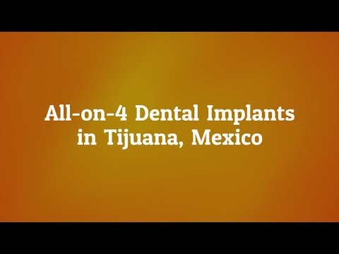 Watch Important Information on All on 4 Dental Implants in Mexicali, Mexico