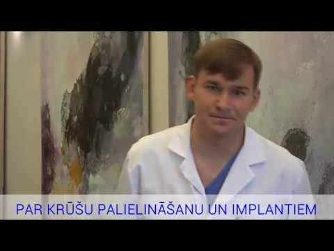 Par krūšu palielināšanu un implantiem