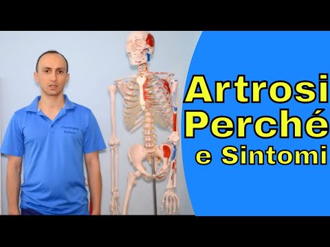 Articolazioni gonfie sulle gambe vicino alle caviglie Quali siano le analisi di consegnare per dolori articolari