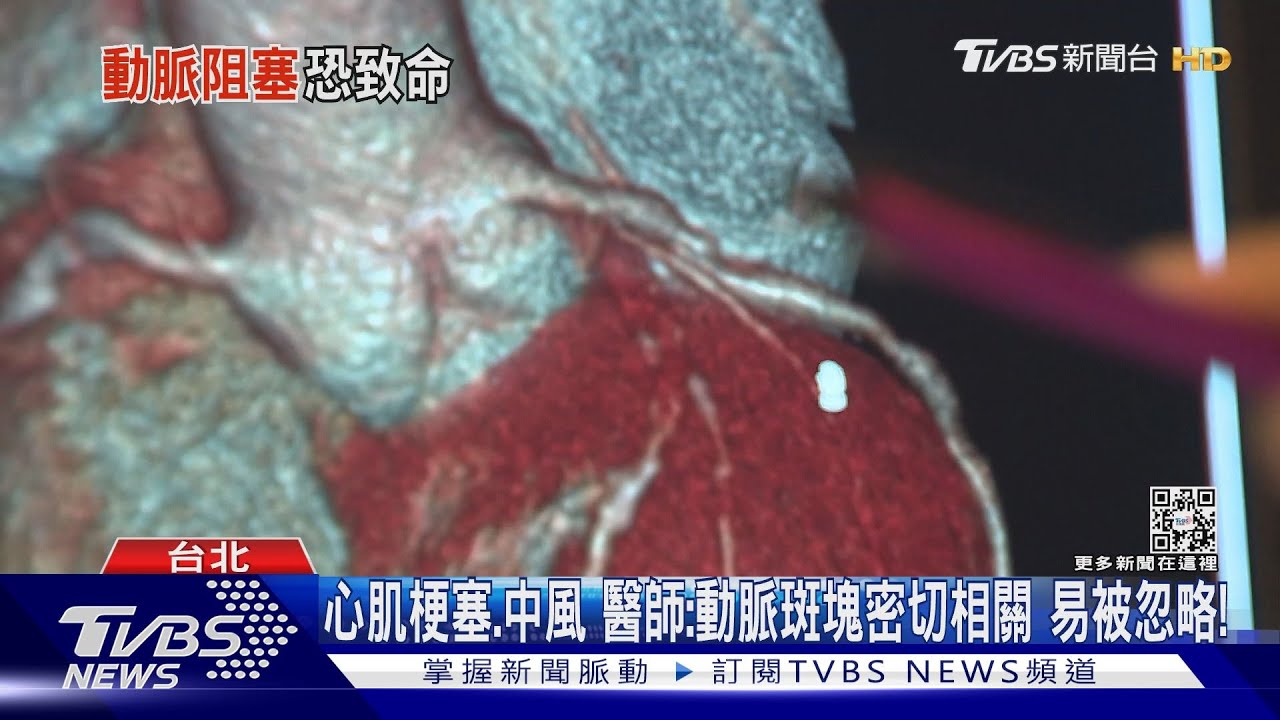輕忽「低密度膽固醇」醫警告:易導致全身動脈狹窄阻塞 恐死亡!