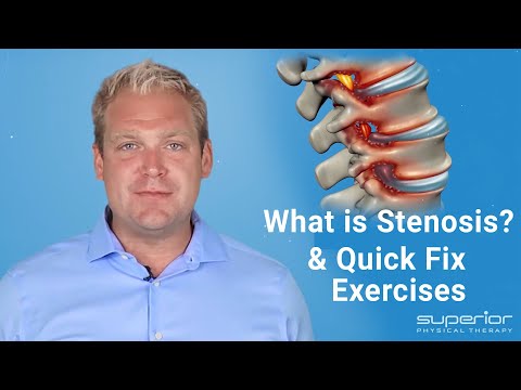 What is Stenosis & Sciatica - Test for Stenosis & Sciatica - Quick Fix Exercises | Dr. A. Gorecki