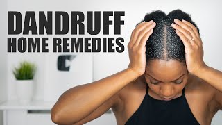 8 HOME REMEDIES to FIGHT DANDRUFF!