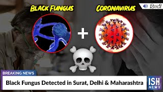 Black Fungus Detected in Surat, Delhi & Maharashtra