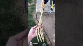 Download lagu The bones in your arm actually cross! mp3