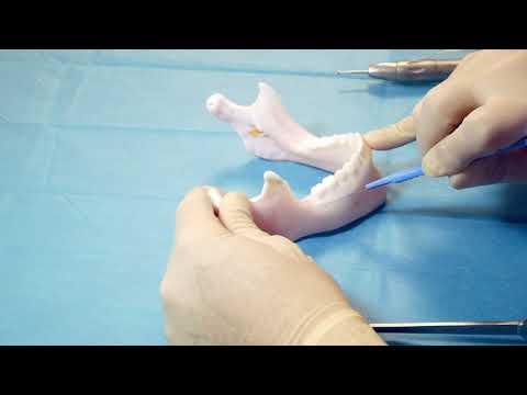 Ostéotomie sagittale mandibulaire (OSBM) sur un modèle BUCCO-train