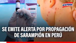 🔴🔵 Advierten riesgo de propagación de sarampión en el sur del Perú, la Amazonía y Lima