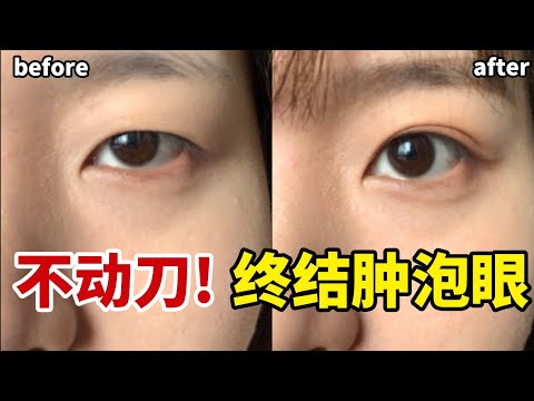 眼睛無神