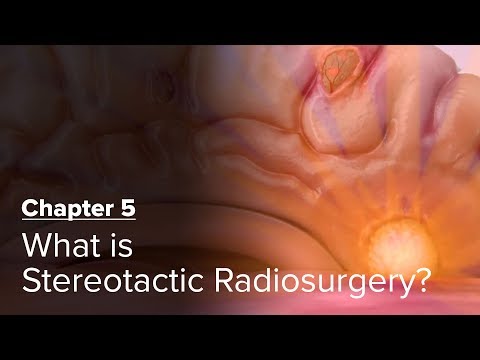 What is Stereotactic Radiosurgery? Chapter 5 — Brain Metastases: A Documentary