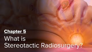 What is Stereotactic Radiosurgery? Chapter 5 — Brain Metastases: A Documentary