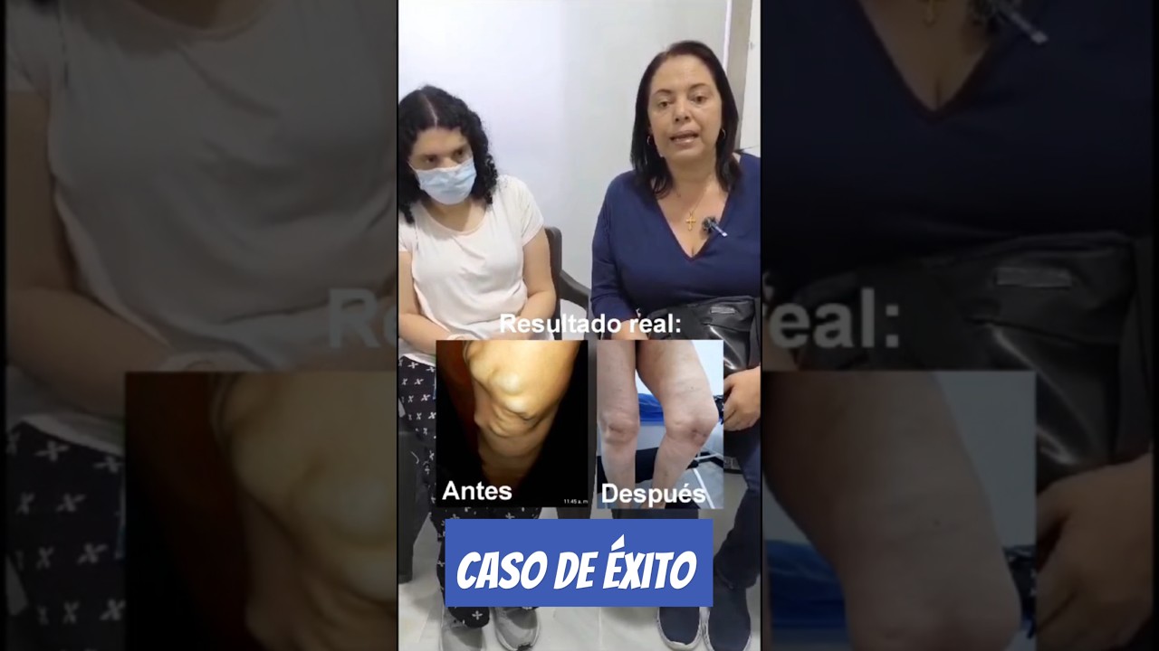 Luis Alberto Moreno Vera-7