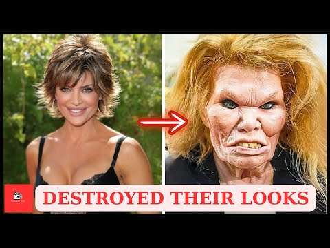 25 Hollywood Stars Who Destroyed Their Looks With Plastic Surgery Regrets | Then And Now 2025