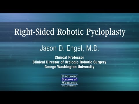 Right Sided Robotic Pyeloplasty