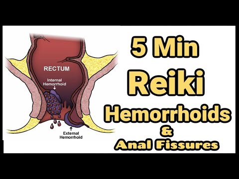 Reiki For Hemorrhoids  + Anal  Fissures  l 5 Minute Session l Healing Hands Series