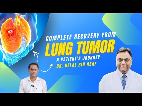 Lung Tumor – Complete Recovery Patient Journey