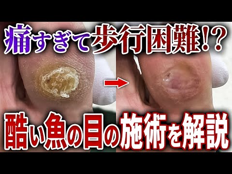 施術動画5