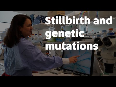 World first discovery links lymphatic disorder to stillbirth