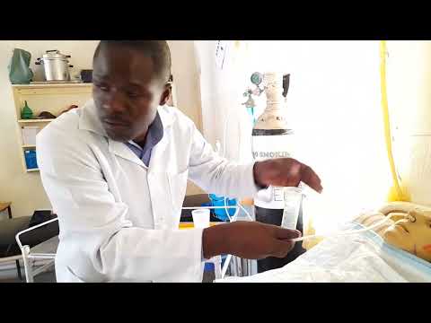 Nasal gastric tube feeding