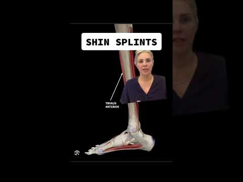 A Podiatrist Explains Shin Splints #shinsplints #footdoctor #running