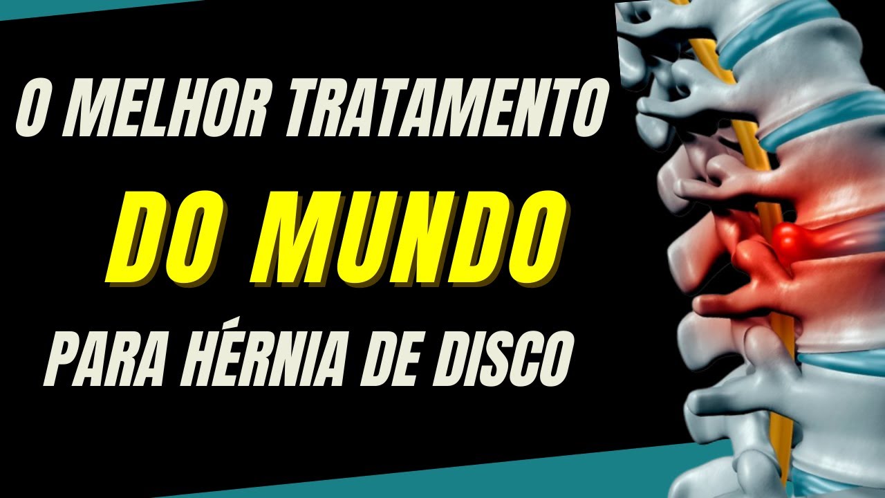 O Melhor Tratamento do Mundo para Hérnia de Disco