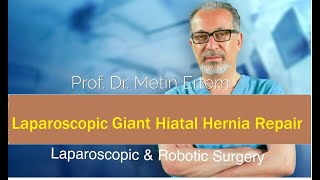 Miniaturka - Laparoscopic Giant Hiatal Hernia Repair. Metin Ertem MD.FACS.