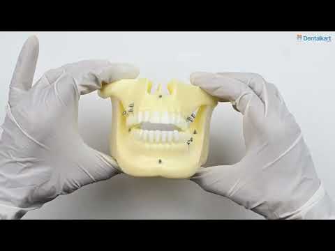 iDentical Orthodontic Implant Model M2016