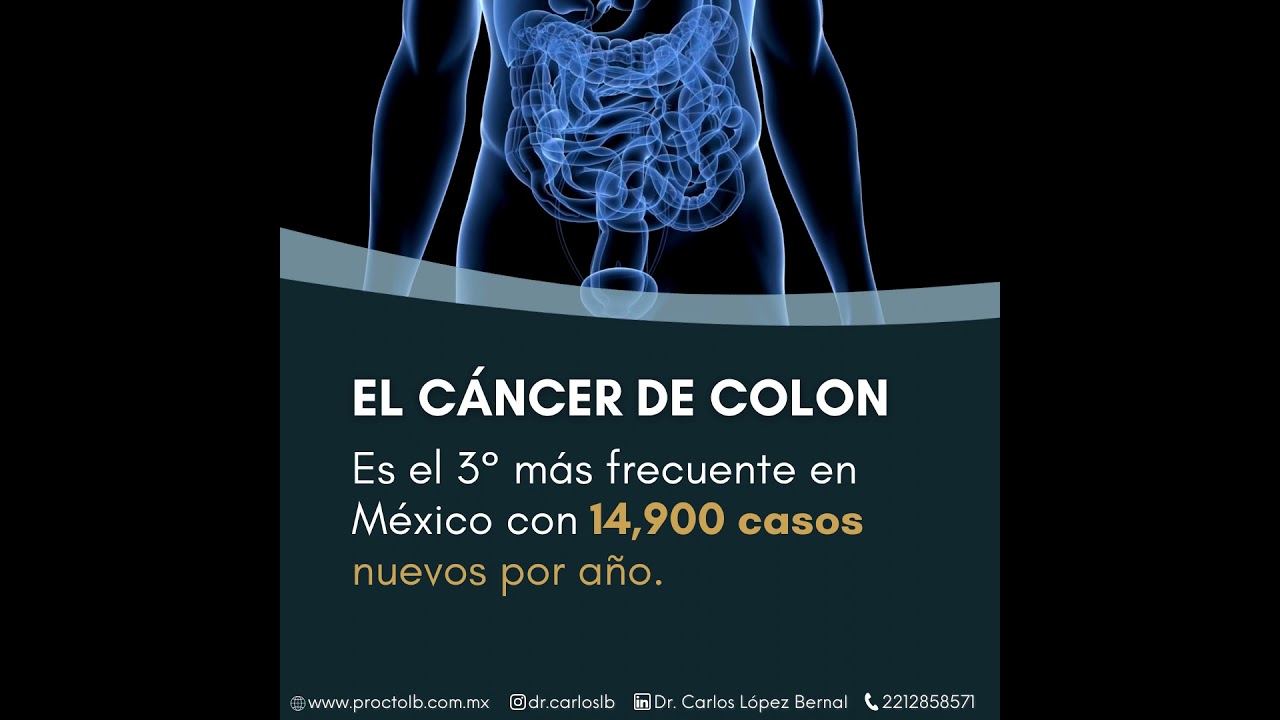 Carlos Alberto López Bernal-21