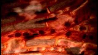 What happens during a Heart Attack?