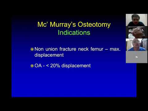 TO PASS DNB/MS ORTHOPAEDICS - VIDEO 71 - OSTEOTOMY OF FEMUR - BY DR. J A PACHORE