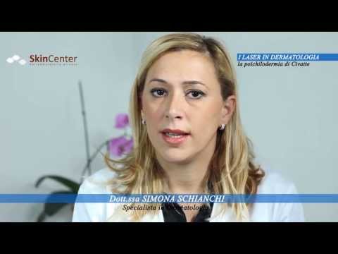 Il neurodermatitis o la dermatite atopic come trattare Cura di sanatorio di eczema su