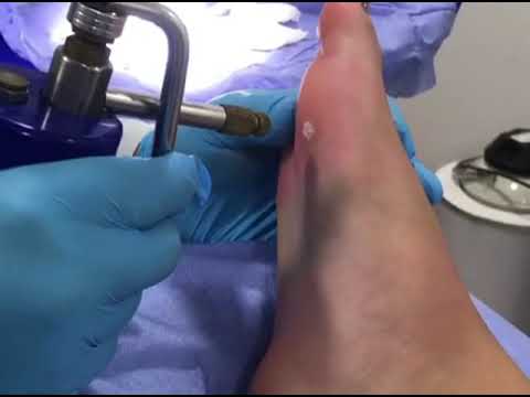 video H_z-_Ti90Js