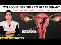 வீடியோக்கள் 34 Video thumbnail