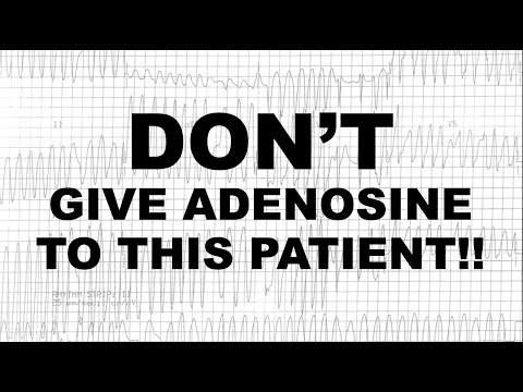 Don't Give Adenosine To This Patient!