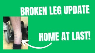 Broken Leg Update #4.   Out of Hospital