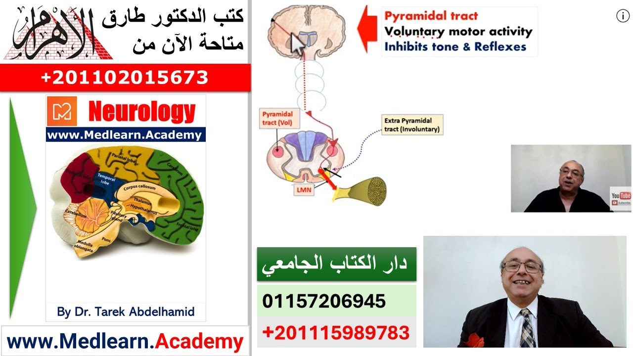 Localization of Neurological Lesions (Part 4) #internal_medicine #cme #محاضرات_باطنة