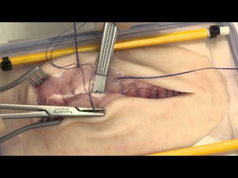 Opening and closing a midline incision (simulated)