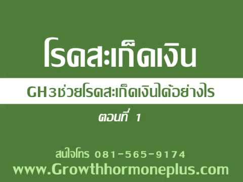 ซื้อยาหม่องโรคสะเก็ดเงินร่างกายบริสุทธิ์ SDA-2 กลาก