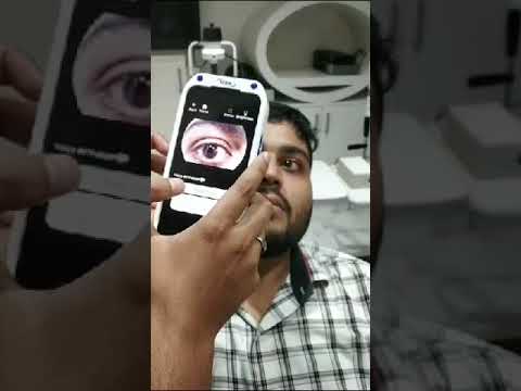 VOLK IN VIEW VISTA FUNDUS CAMERA  @JDMEDICALSYSTEMS