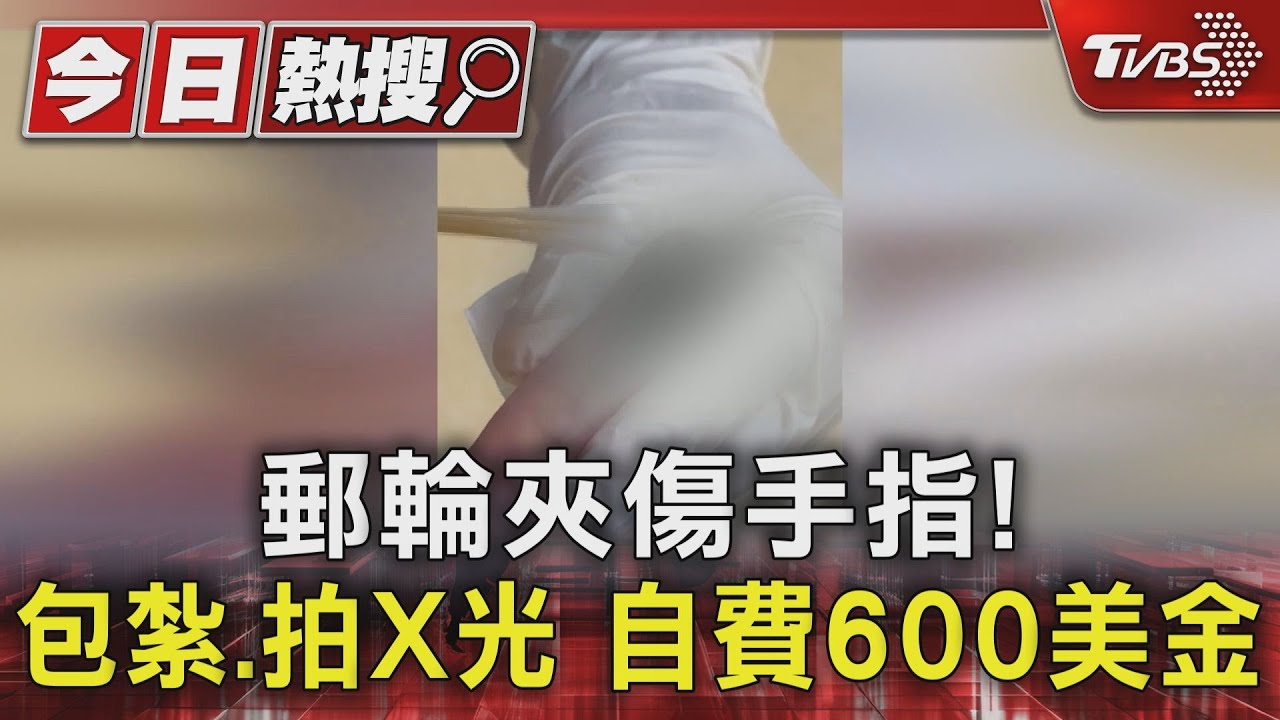 郵輪好貴!醫藥費能再玩一天... 包紮、X光竟要價2萬元