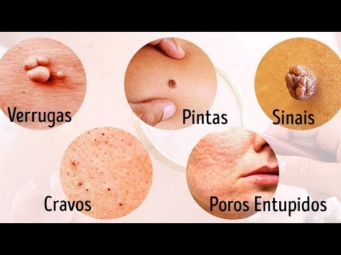 8 Doenças sérias sinalizadas pela nossa pele
