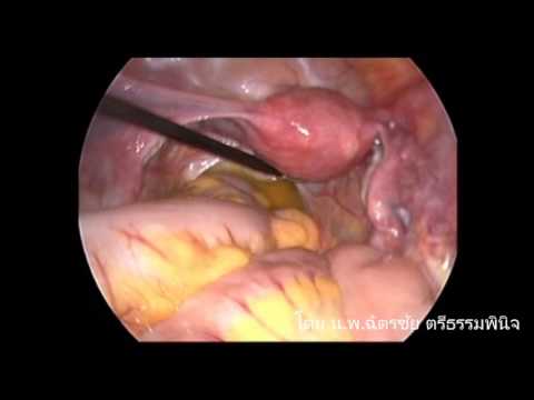 อวัยวะเพศชายหนุ่ม 2 ปี Exciter สำหรับการดำเนินการอย่างรวดเร็วของผู้หญิงในร้านขายยาใน Voronezh