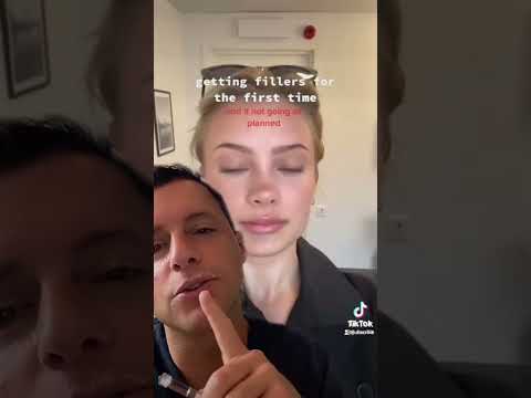 LIPPEN aufspritzen SCHIEF GEGANGEN 😱 Dr. Rolf Bartsch #shorts #plasticsurgery