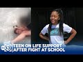Teen on life support after fight outside middle school