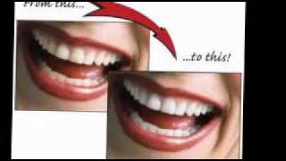 Astrud Gilberto - The shadow of your smile
