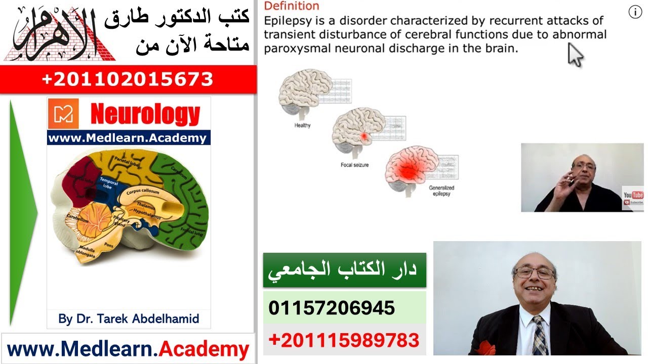 Epilepsy (1) [Neurology} 1 Medical Quizzes #CME #Internal_Medicine  #ECG #usmle    محاضرات باطنة#