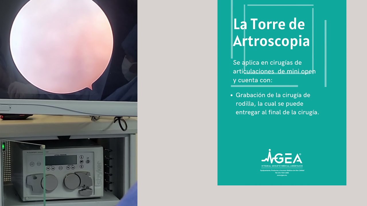 Artroscopia de Rodilla en Guadalajara | Torre de Artroscopia Stryker | Tel: 3315432686