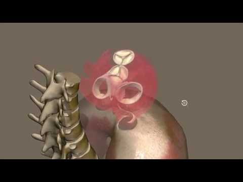Apparato cardiocircolatorio 03: Scheletro del cuore