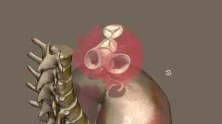 Apparato cardiocircolatorio 03: Scheletro del cuore