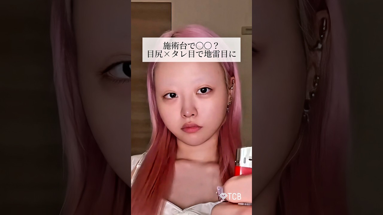 【目尻切開】施術台で〇〇？目尻×タレ目で地雷目に #shorts