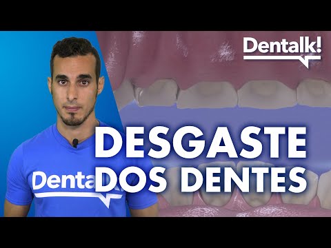 Vídeo: Desgaste dos dentes